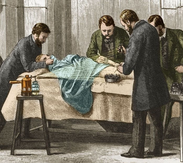 equipos-biomedicos_Descubrimiento de los antisépticos Joseph Lister